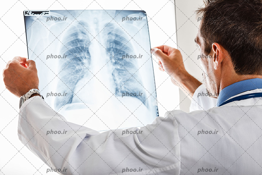 عکس با کیفیت عکس قفسه سینه در دست دکتر و دکتر در حال برسی عکس