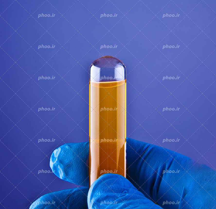 عکس با کیفیت شیشه کوچک پر شده از مایع زرد رنگ در دست پزشک با دستکش آبی در پس زمینه بنفش