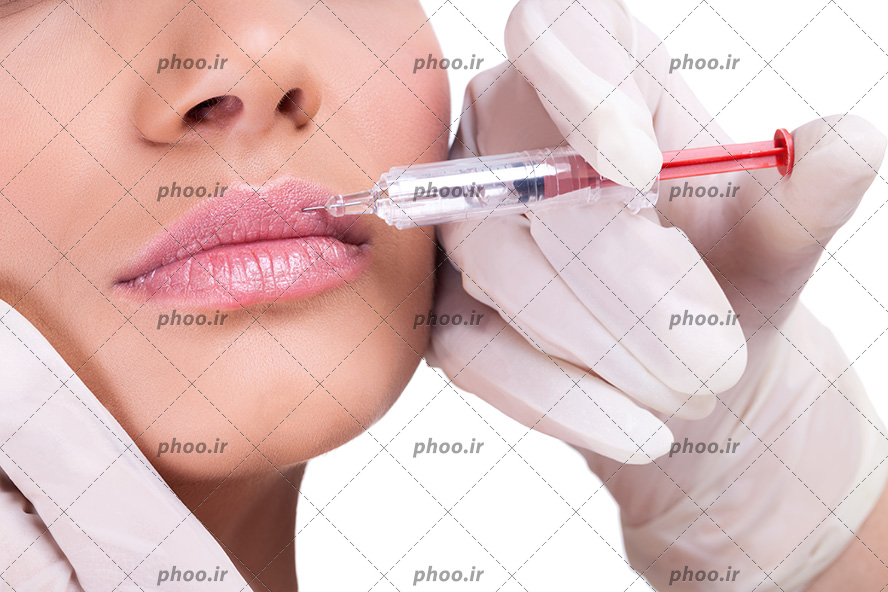 عکس با کیفیت پزشک با دستکس سفید و سرنگ در دست در حال تزریق ژل به لب های زن