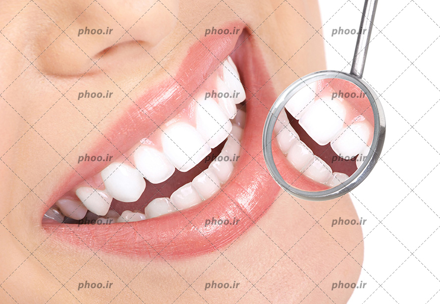 عکس با کیفیت زن با لبخند زیبا و دندان های سفید و براق و آینه گرد دندان پزشکی در کنار دهان و در حال نشان دادن دندان های زن