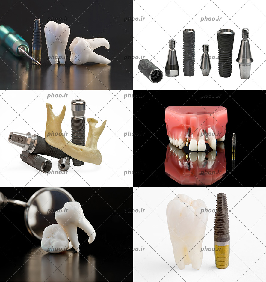 عکس با کیفیت تجهیزات مورد نیاز برای مراحل کاشت ایمپلنت دندان