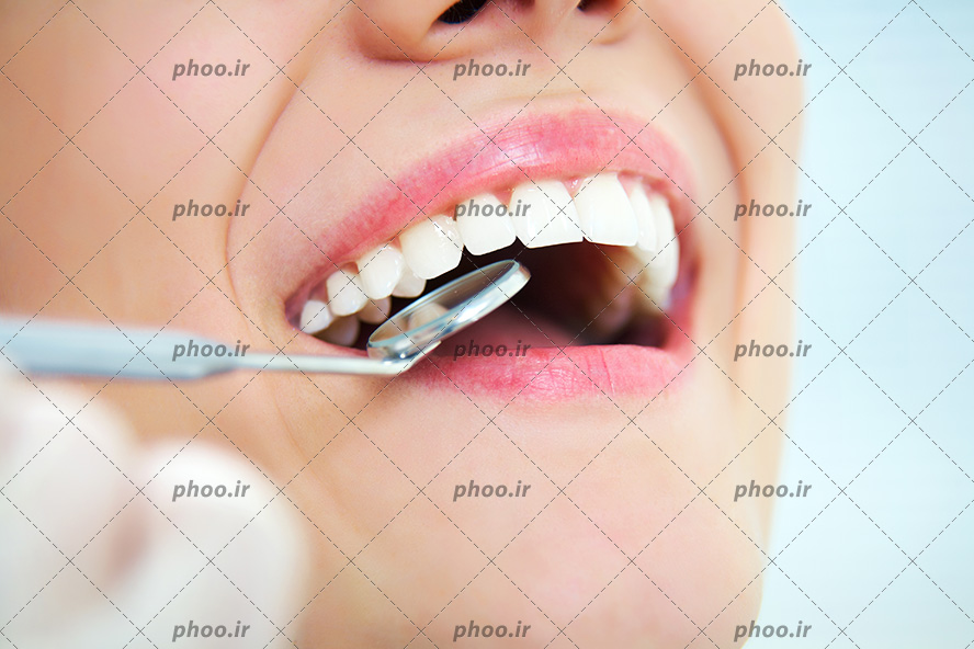 عکس با کیفیت دندان پزشک در حال معاینه دندان های زن با آینه گرد کوچک مخصوص دندان پزشکی