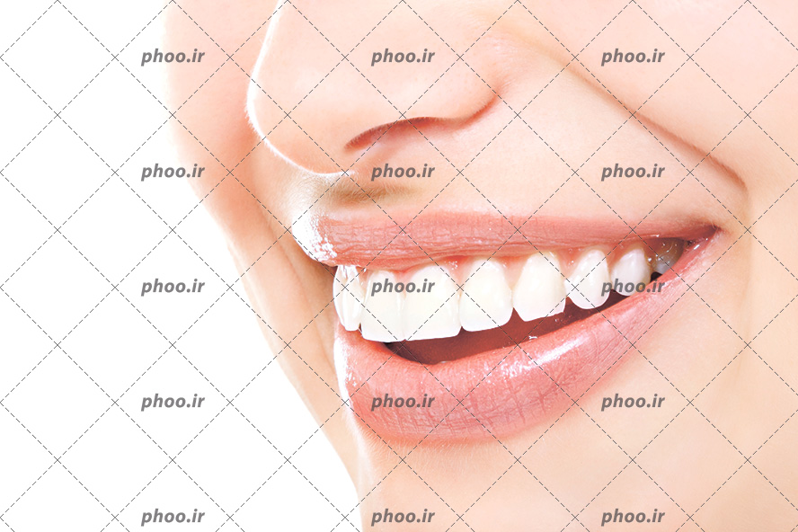 عکس با کیفیت لب های خندان زن از نمای نزدیک و دندان های سفید و براقش