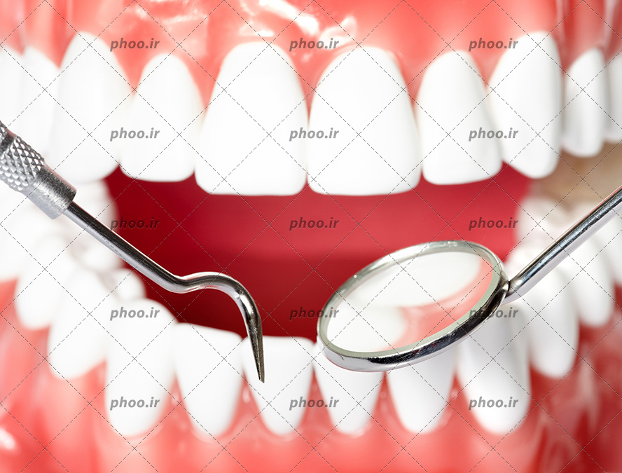 عکس با کیفیت معاینه دندان های سفید و لثه های صورتی به کمک آینه مقعر دندانپزشکی