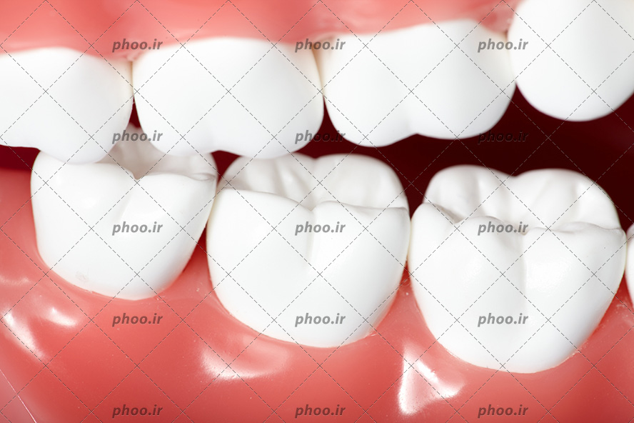عکس با کیفیت دندان های سفید و لثه های سالم به رنگ صورتی از نمای نزدیک