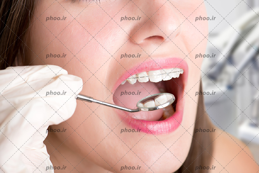 عکس با کیفیت پزشک در حال معاینه دندان های زن با استفاده از آینه مقعر