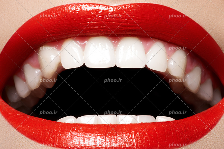 عکس با کیفیت زن با لب های قرمز و دندان های سفید و براق در حال خندیدن