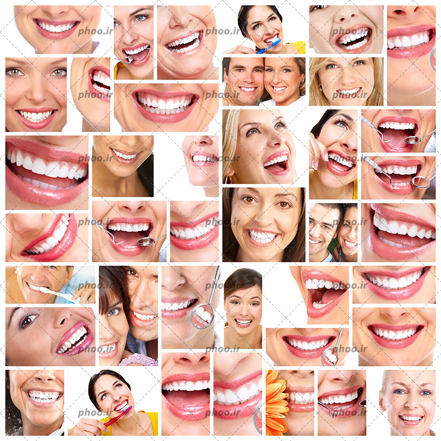 عکس با کیفیت خانم ها با لبخند زیبا و دندان های سفید و درخشان در کنار یکدیگر