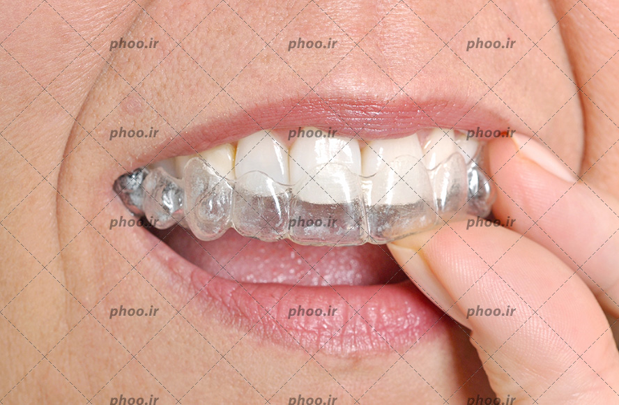 عکس با کیفیت پیر زن در حال گذاشتن روکش دندان برای حفظ و نگهداری از دندان های سالم خود
