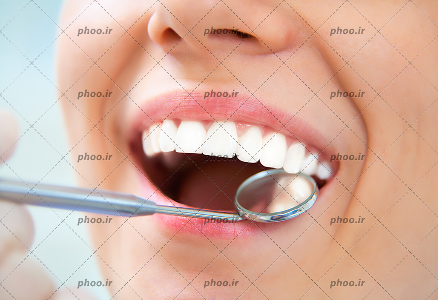 عکس با کیفیت پزشک در حال دیدن و معاینه کردن دندان های زن به کمک آینه مقعر