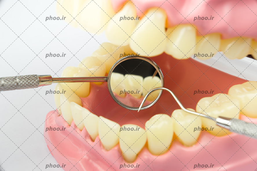 عکس با کیفیت نشان دادن داخل دندان مصنوعی و دندان ها به رنگ زرد