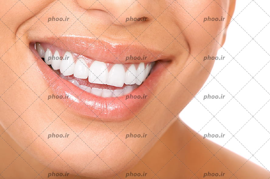 عکس با کیفیت زن با رژ براق بر لب های خوش فرمش و دندان های سفید درخشان در حال خندیدن