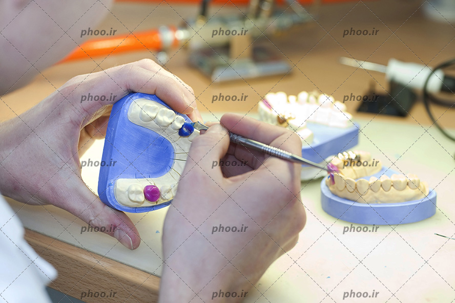عکس با کیفیت پزشک در حال تمرین بر روی ماکت دندان و پر کردن دندان