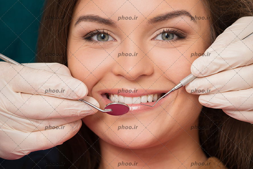 عکس با کیفیت زن زیبا رو در حال خندیدن و نمایان شدن دندان های سفیدش و پزشک در حال معاینه دندان های زن با آینه مقعر و اسکالر