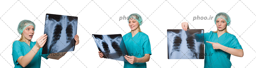 عکس پزشک زن با عکس رادیولوژی در دست با سه زاویه متفاوت در پس زمینه سفید