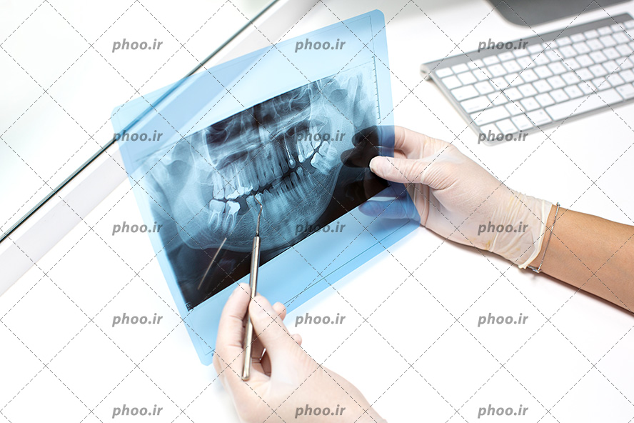 عکس با کیفیت پزشک دندانپزشک در حال برسی عکس رادیولوژی دندان ها